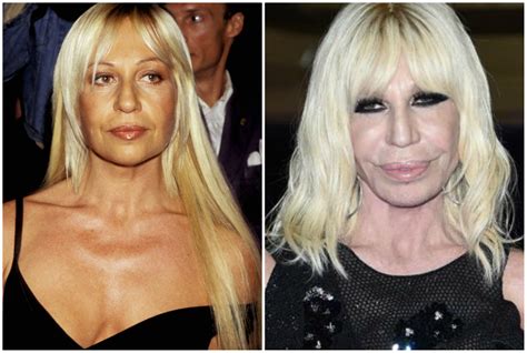 donatella versace prima e ora|Donatella Versace, storia di una donna diventata icona .